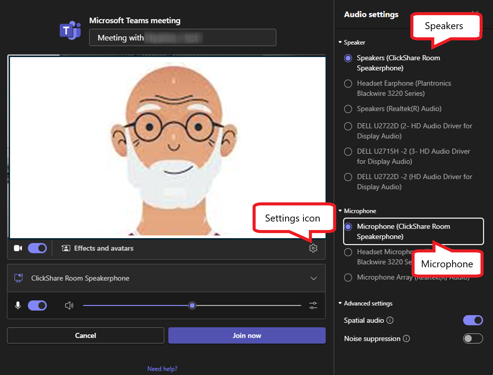 kb2121_mthdone_annotate_02.png